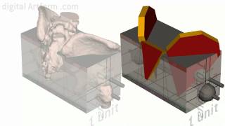 Artistic Anatomy A Simplified View of the Pelvis [upl. by Yaned]