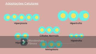 Aula Patologia Hiperplasia e Hipoplasia [upl. by Nugesulo449]