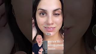 RARE Ptosis From Botox  Doctor Reacts [upl. by Ordway615]