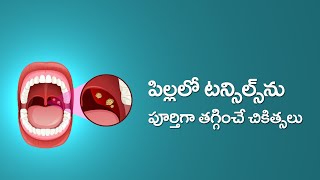 Causes and Cures for Tonsillitis and Adenoiditis in Children in Telugu  టాన్సిల్స్ వాపు [upl. by Cade]