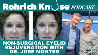 Optimizing nonsurgical eyelid rejuvenation what really works with Dr Montes [upl. by Edroi]