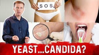 Yeast Infection vs Candida Infection Is there a Difference – DrBerg [upl. by Annail924]