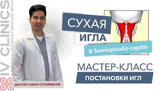 Сухая игла в SEMISPINALIS CAPITIS Полуостистая мышца  Мастеркласс постановки сухой иглы [upl. by Aniroc742]