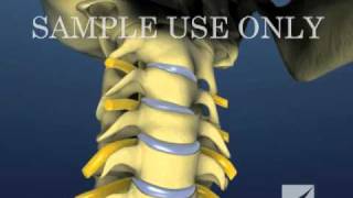 Cervical Spine and Intervertebral Disc Anatomy  Male Version [upl. by Ensoll]