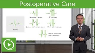 Postoperative Care – Surgery  Lecturio [upl. by Miche]