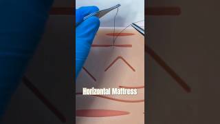 The Horizontal Mattress Suture suturing sutures horizontalmattress stitch wound urgentcare [upl. by Atterehs671]