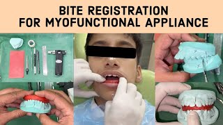 🔵 Step by Step Demonstration on Bite Registration For Myofunctional Appliance in Orthodontics [upl. by Eirellav]