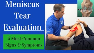 Meniscus Tear Evaluation 5 Most Common Signs and Symptoms [upl. by Cralg93]