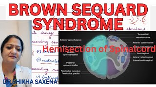 Brown Sequard Syndrome Hemisection of Spinal cord [upl. by Ahswat128]