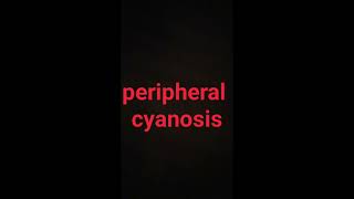 How peripheral cyanosis look like [upl. by Alyar102]