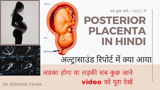 Posterior Placenta in hindi  Placenta position  placenta Grade posterior Placenta क्या होता है [upl. by Ame]