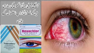 Conjunctivitis Infection Of Eyes  Epidemic In Pakistan Red eyes conjunctivitis [upl. by Anahir]