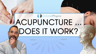 Does Acupuncture Work in Physiotherapy  Expert Physio Reviews the Evidence [upl. by Crespi]