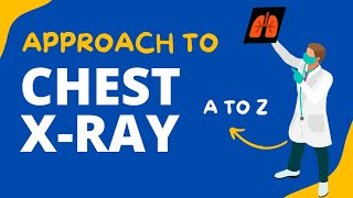 How to Interpret Chest XRay  A to Z  Interpret Any Chest XRay After Watching This [upl. by Valle383]