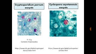 Para Findings 7 Cryptosporidium Cyclospora and Cystisospora in Stool with MZN stain [upl. by Mascia205]