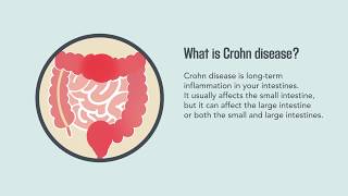 Crohn Disease Signs Symptoms Causes and Treatment  Merck Manual Consumer Version [upl. by Artnoed]