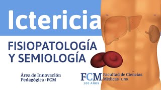 Ictericia  Fisiopatología y Semiología [upl. by Jat74]