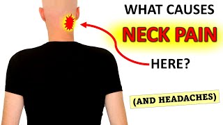 What Causes Upper Neck Pain And Headaches [upl. by Wylie]