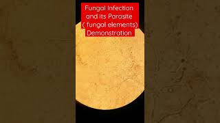 Fungal infection and its parasite Demonstration [upl. by Hilel]