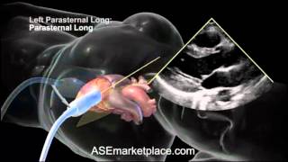 How to do a Basic Transthoracic Echocardiogram Transducer Position and Anatomy [upl. by Einre]