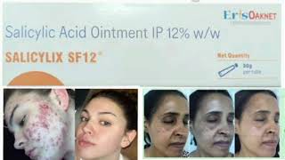 SALICYLIX SF12 Ointment Cream Salicylic Acid Ointment IP 12 ww [upl. by Matthaeus]