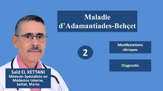 Manifestations clinique et Diagnostic de la maladie de Behçet [upl. by Notgnimer]