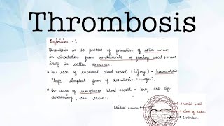 THROMBOSIS PATHOLOGY [upl. by Kaltman]