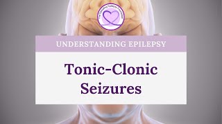 What are TonicClonic Seizures [upl. by Dacie954]