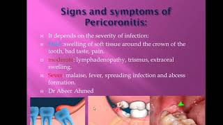 47 Signs symptoms and treatment of PericoronitisMFDS MJDF ORE [upl. by Ydieh]