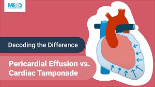 Decoding the Difference Pericardial Effusion vs Cardiac Tamponade [upl. by Winer]