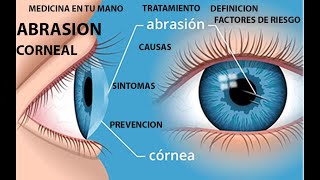 abrasión corneal [upl. by Adnavoj987]