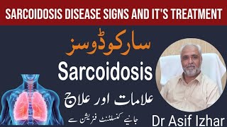 sarcoidosis treatment in hindi  sarcoidosis disease in hindi  sarcoidosis in urdu dr asif izhar [upl. by Drus71]