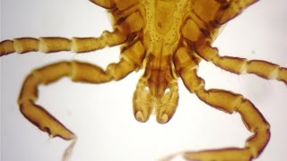 Ixodes scapularis tick  vector of Lyme disease  Borrelia burgdorferi [upl. by Rolanda83]