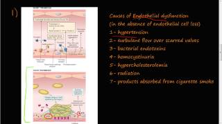 53  Thrombosis Virchows triad Endothelial Injury [upl. by Aneehsram]