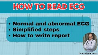 Mastering ECG Reading  Simplified Guide for Interns General Practitioners and Medicine Residents [upl. by Ellicott416]