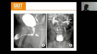 Urological investigation 03 Cystogram Urethrogram Antrograde Transrectal Ultrasound [upl. by Giaimo997]