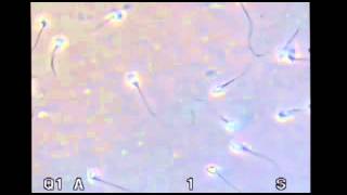 SPERM MOTILITY EXAMINED [upl. by Zinnes]