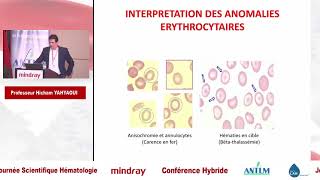 Interprétation d’Hémogramme dans un Laboratoire d’Hématologie [upl. by Ennoitna600]