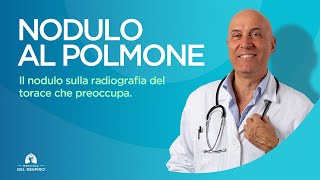 NODULO AL POLMONE il Nodulo sulla Radiografia del Torace che Preoccupa [upl. by Rao]