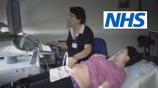 What happens at a scan and what will they tell me  NHS [upl. by Worden149]