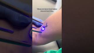 Laser tattoo removal shorts [upl. by Yemiaj371]