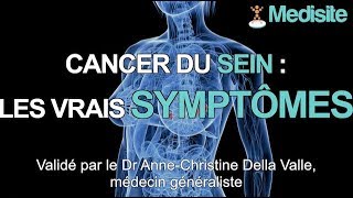 Savoir reconnaître les vrais symptômes dun cancer du sein [upl. by Isidro446]