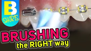 Brushing with Braces Explained  Electric Toothbrush Shorts [upl. by Romeo158]