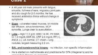 Detecting Vasculitis Before Its Too Late [upl. by Ruella]