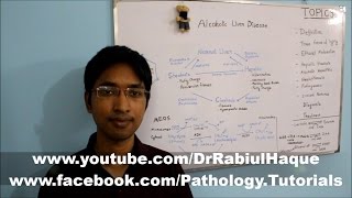 Alcoholic Liver Disease Part 1 HD [upl. by Ddot]