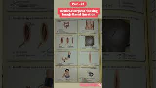 Medical surgical nursing image based questions 🎯 medicalsurgicalnursingNursingNursingofficer [upl. by Violetta]