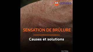 Sensations de brûlure  Causes et solutions [upl. by Eiloj537]