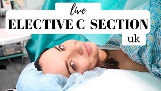 LIVE C SECTION VLOG UK  LIVE CEASAREAN SECTION BIRTH VLOG NHS 2019 [upl. by Styles]