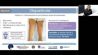 Artritis idiopática juvenil y artritis reumatoide [upl. by Terencio]