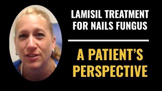 Lamasil Treatment For Treating Nail Fungus onychomycosis [upl. by Orelee]